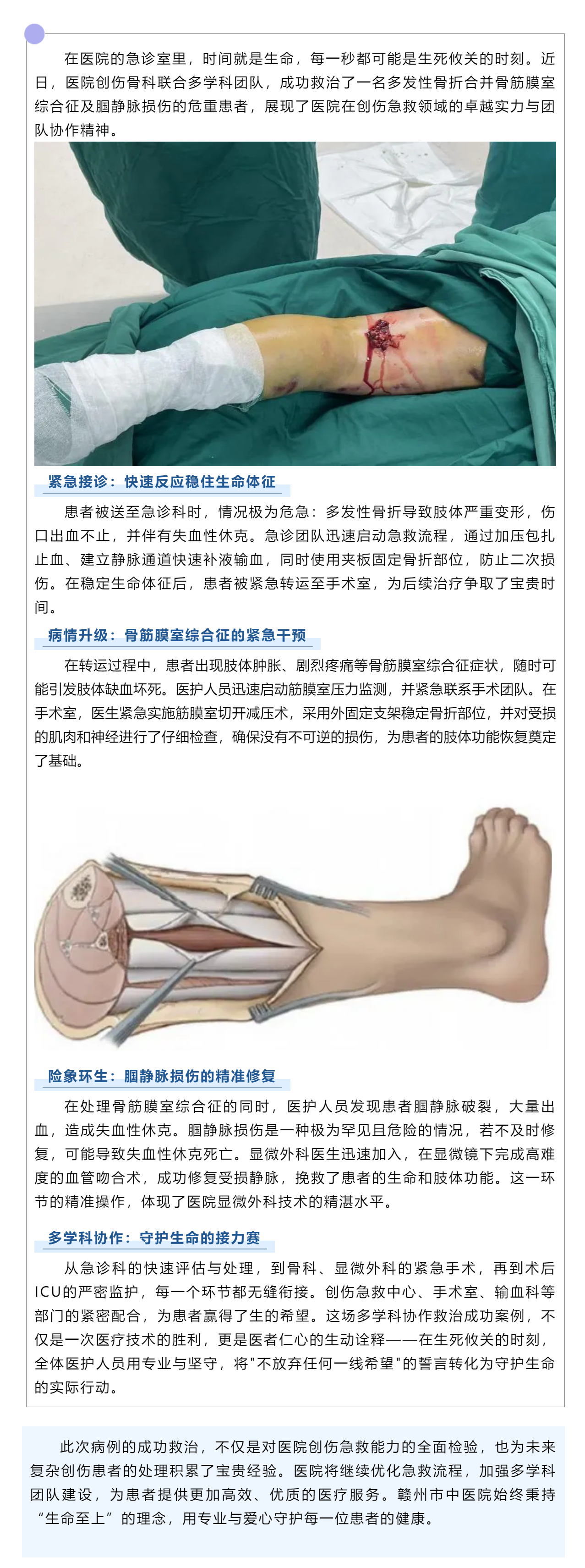 生死時速！多學科協作成功救治多發性骨折合并嚴重并發癥患者.png